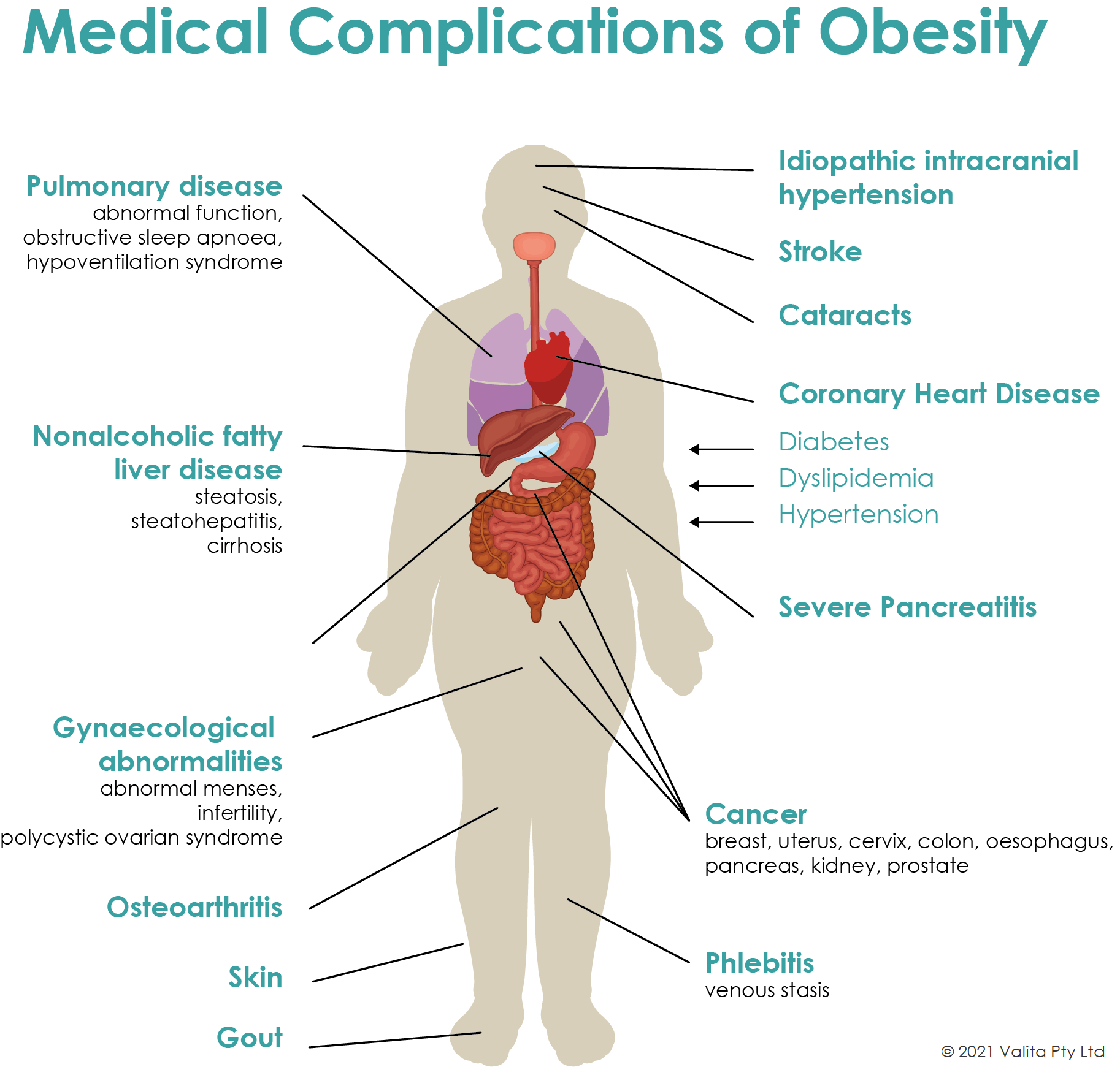 Complications of Obesity